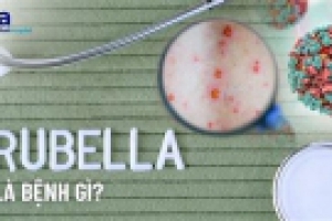 Nhiều trường hợp mắc rubella, dấu hiệu nào nhận biết bệnh sớm?